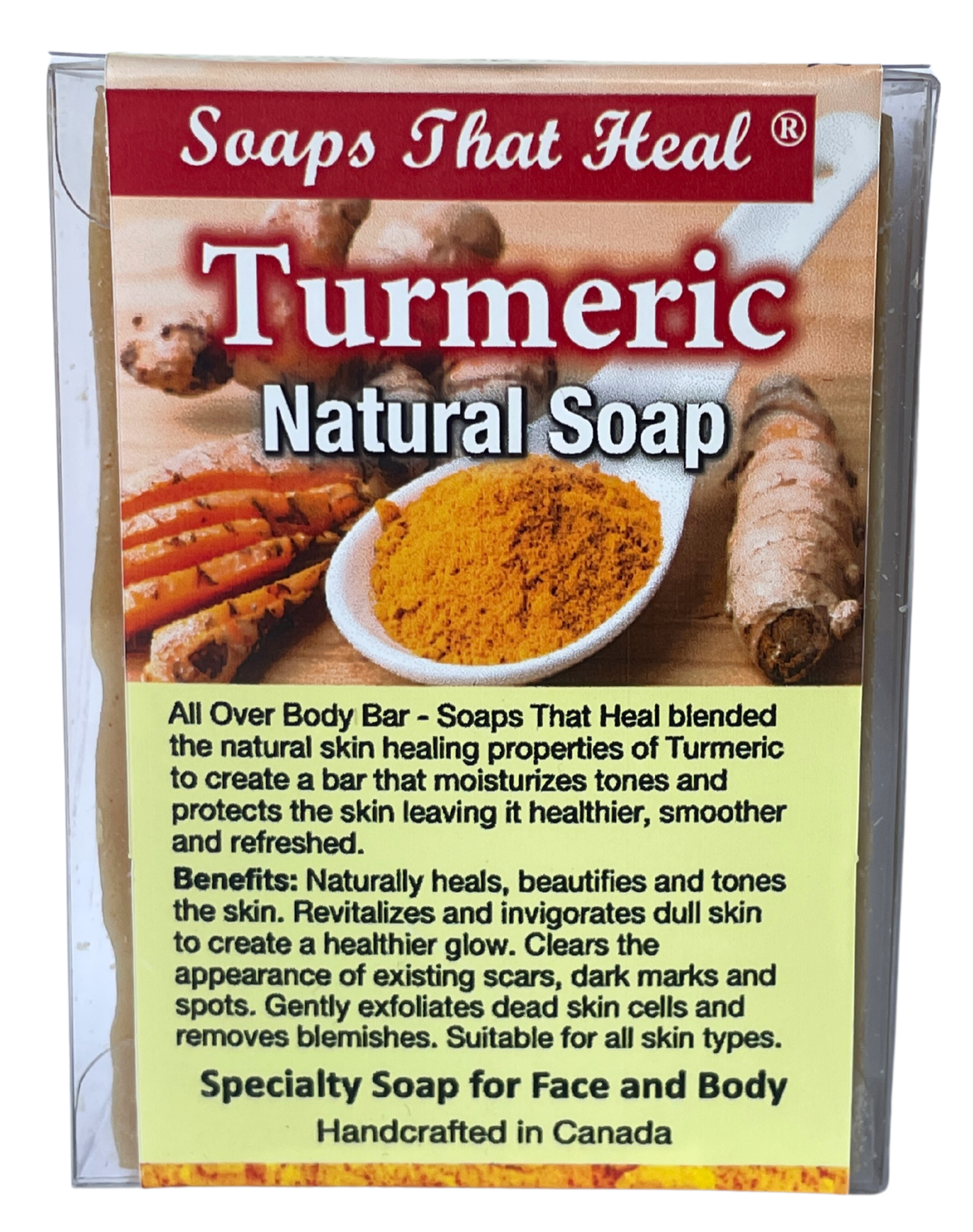 natural alternatives to whitening creams,fade creams,bleaching creams,Remove Dark Spots and Acne,aspen kay,Healthy Skin, Natural Products Skin Care, problem skin,Turmeric Soap,the best body soap,saje,soaps that heal,healing soap, how to get rid of dark marks,dark spots,whitening soaps,lightening soaps,hyperpigmentation