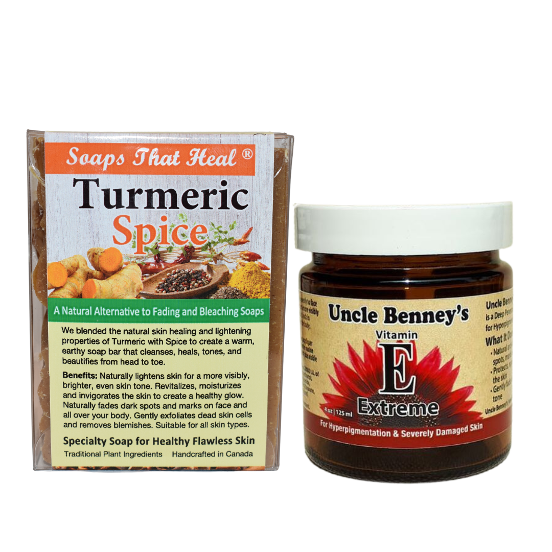 Control and get rid of facial hyperpigmentation, soaps that heal turmeric spice bar for severe facial hyperpigmentation. The best face cream for hyperpigmentation on the face. How to naturally fade dark marks. How to even out your skin with organic skincare products. Uncle Benney's vitamin E extreme moisturizer