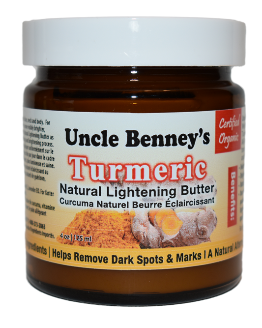 soaps that heal,uncle benney’s,acne,night treatment,facial cream,scrub,dyi face mask, blemishes,dry skin,face cream,face moisturizer,glowing skin,how to clear acne,how to clear your skin,how to have Glowing Skin,oilblends,how to hydrate skin,mask,clay,repair cream,clear,reduce hyperpigmentation,turmeric butter,oils,turmeric cream,face mask,remove dark marks,spots,turmeric face mask butter,Facial Acanthosis Nigricans,asymptomatic, velvety hyperpigmentation