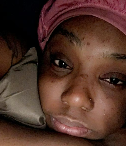 how to clear your dark marks and sots using natural ingredients, OilBlends Products customer review, uncle benney's, soaps that heal