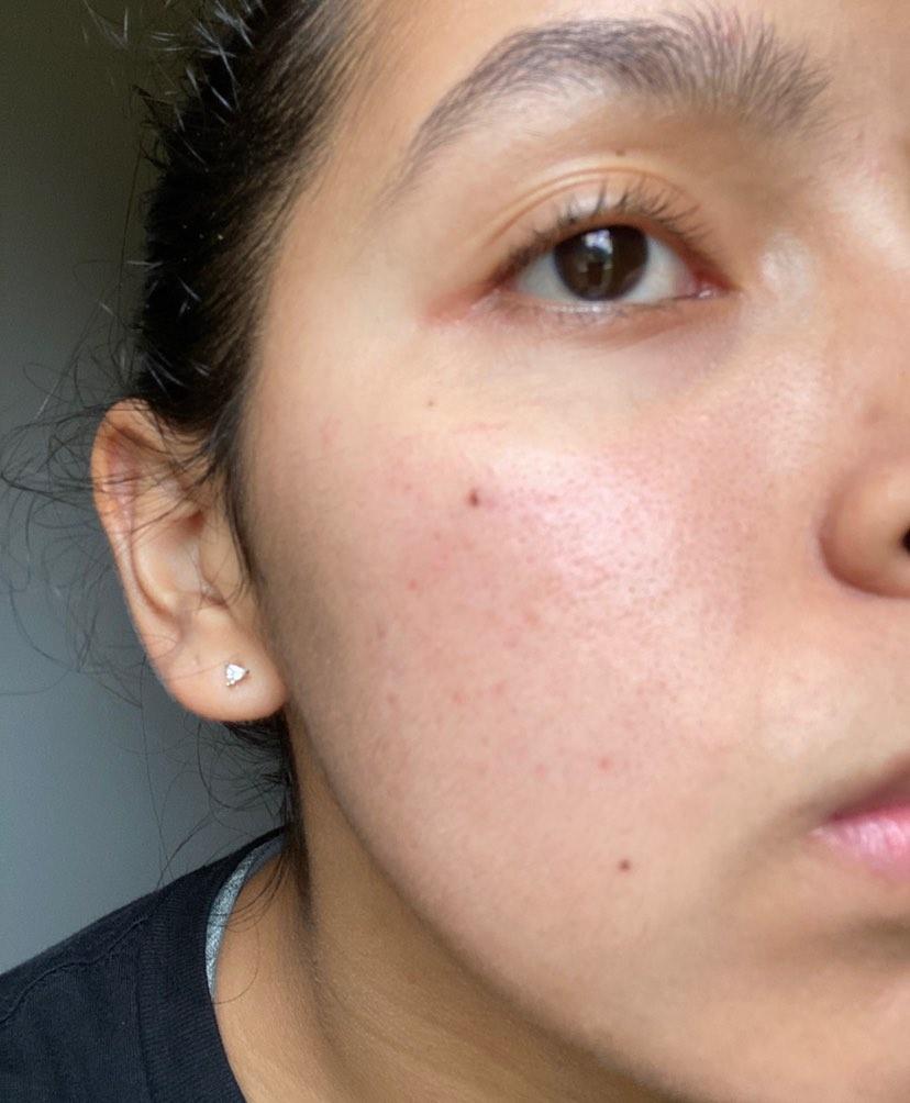 how to reduce hyperpigmentation, vitamin e cream, vitamin e, turmeric butter, how to treat acne, turmeric soap, fading cream, whitening cream, vitamin e cream, hyperpigmentation, brightening cream, natural skincare products, pimples, skin hydration, skincare, skincare routine, skincare tips, turmeric, turmeric skincare, bleaching cream, turmeric butter, turmeric soap,healthy skin system