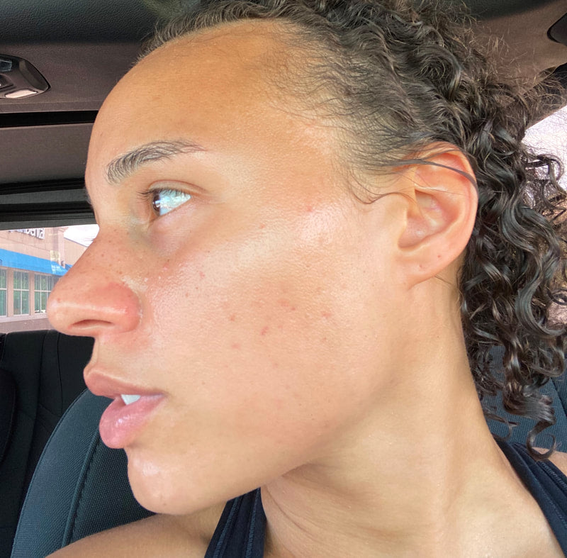 uncle benneys soaps that heal turmeric natural lightening butter & turmeric natural lightening soap for glowing skin