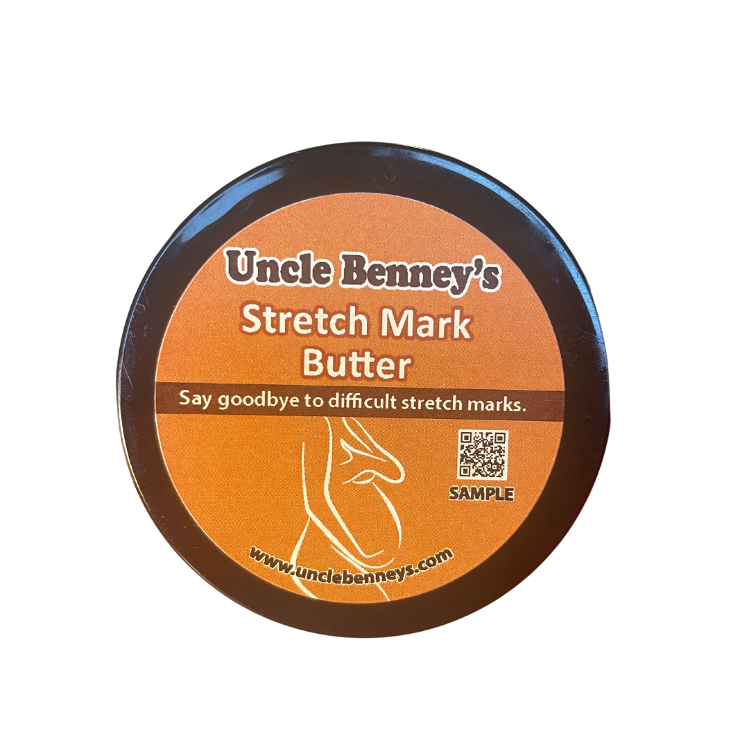 Uncle Benney's Stretch Mark Butter, a natural alternative to chemical ingredients, oilblends, Palmer's cocoa butter , stretch mark cream, smooth skin, pregnancy stretch mark remover