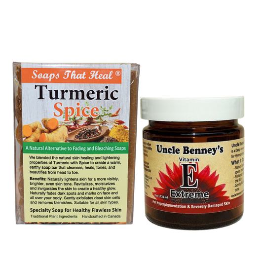 Control and get rid of facial hyperpigmentation, soaps that heal turmeric spice bar for severe facial hyperpigmentation. The best face cream for hyperpigmentation on the face. How to naturally fade dark marks. How to even out your skin with organic skincare products. Uncle Benney's vitamin E extreme moisturizer 