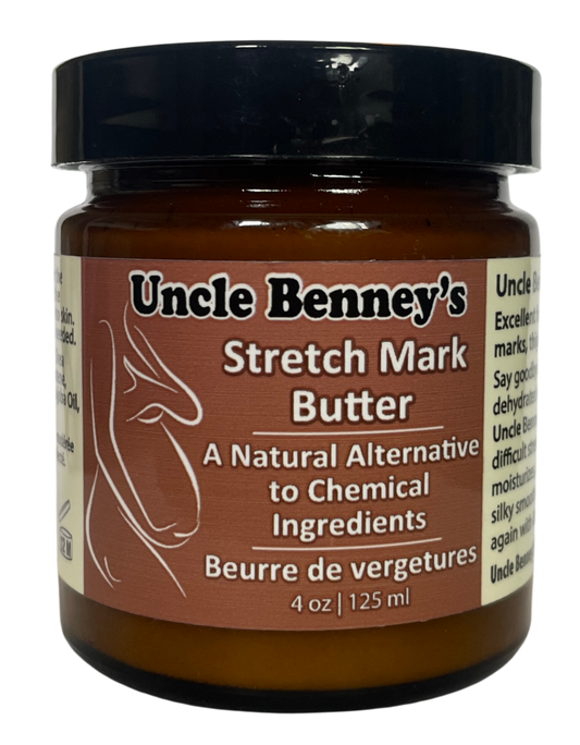 Uncle Benney's Stretch Mark Butter, a natural alternative to chemical ingredients, oilblends, Palmer's cocoa butter , stretch mark cream, smooth skin, pregnancy stretch mark remover