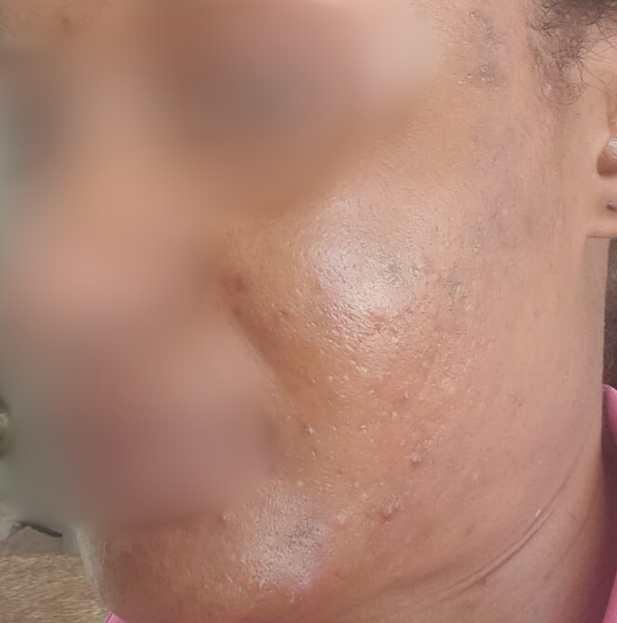 skincare products to help remove dark marks and spots on the face for black skin, uncle benney's products, oilblends natural skincare, soaps that heal review