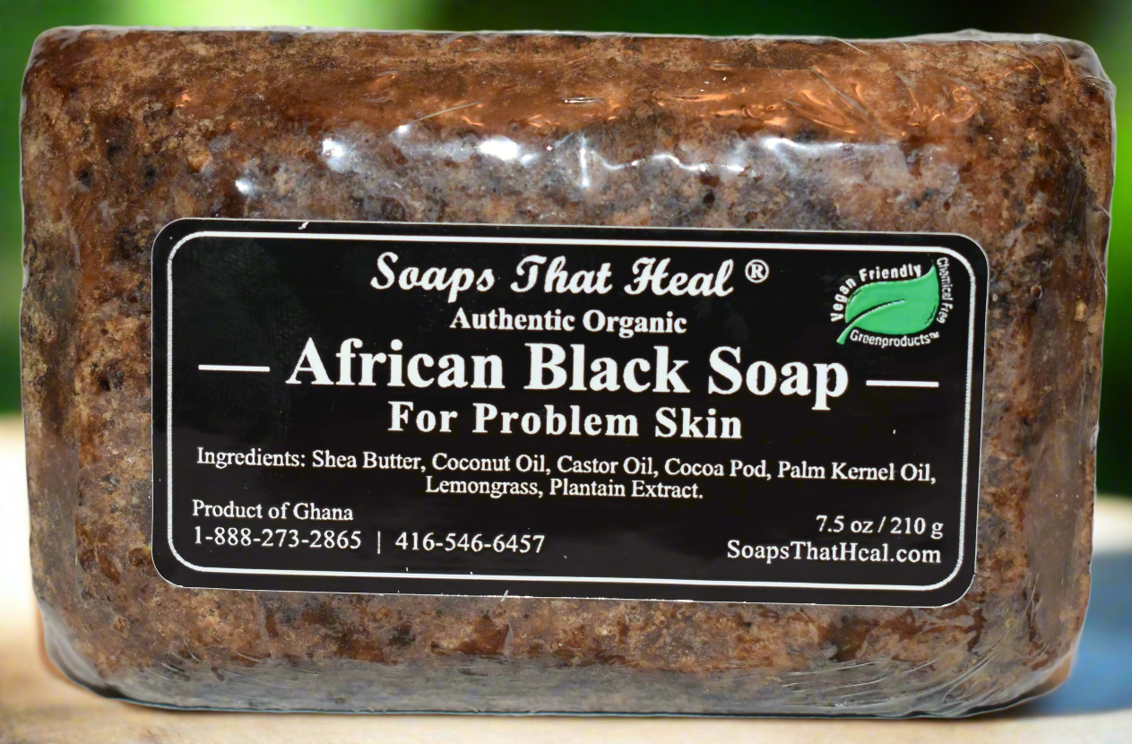 soaps that heal african black soap ,products of ghana, shea butter, plantain extract ,hyperpigmentation deep cleansing plantain extract,african black soap to remove dark marks, black soap for hyperpigmentation,african black soap benefits,how to use african black soap,raw black soap,black soap for face,acne afrian black soap,Facial Acanthosis Nigricans,asymptomatic, velvety, clear facial hyperpigmentation, remove dark marks and spots, castor oil, healthy skin treatment, clean products,