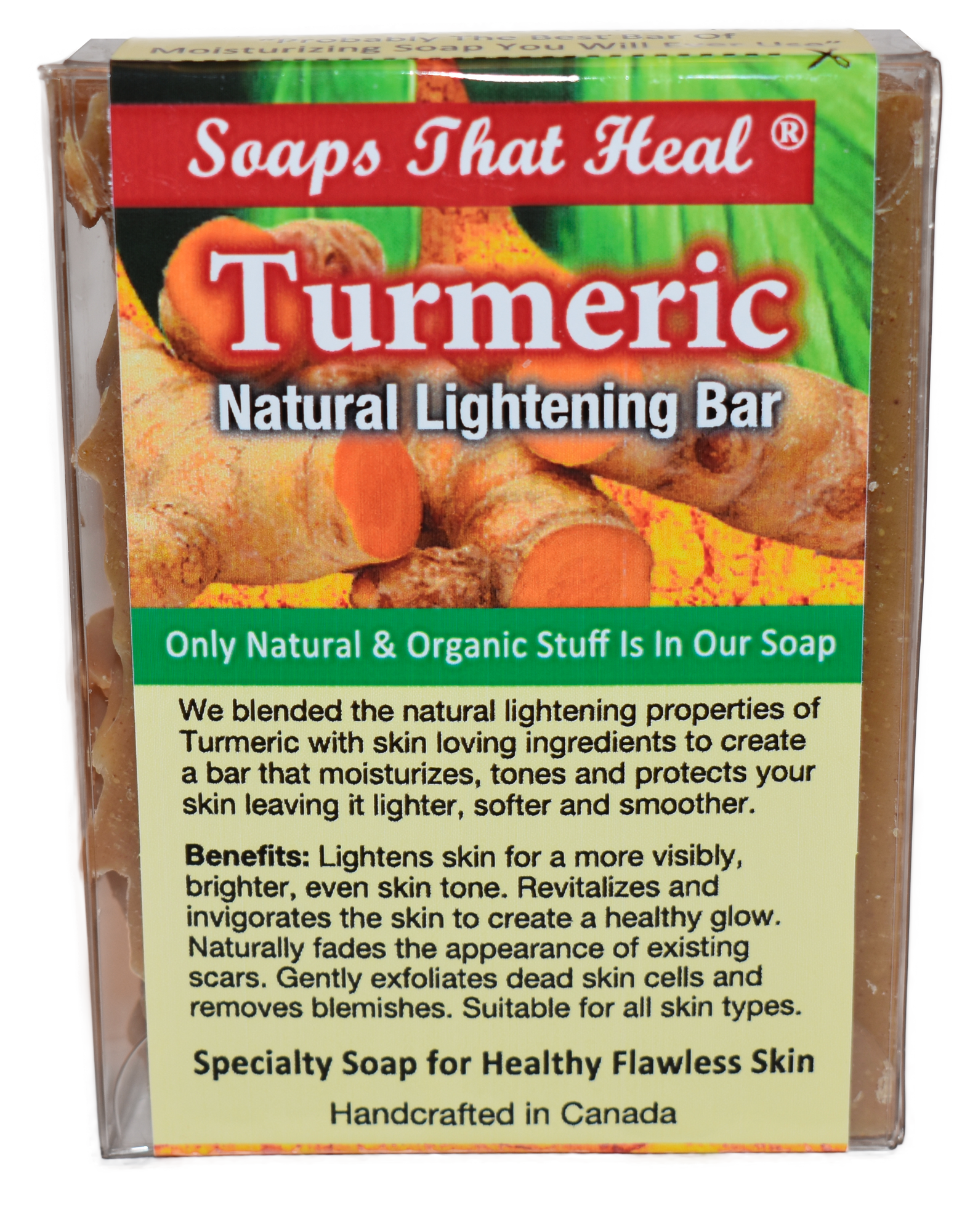 soaps that heal turmeric soap, natural lightening, natural alternatives to whitening creams,fade creams,bleaching creams,Remove Dark Spots and Acne,aspen kay,Healthy Skin, Natural Products Skin Care, problem skin,Turmeric Soap,the best body soap,saje,soaps that heal,healing soap, how to get rid of dark marks,dark spots,whitening soaps,lightening soaps,hyperpigmentation, best turmeric soap,oilblends,uncle benney's,soaps that heal